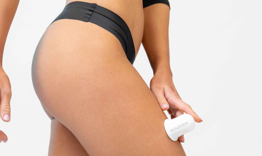 cellulite glutei