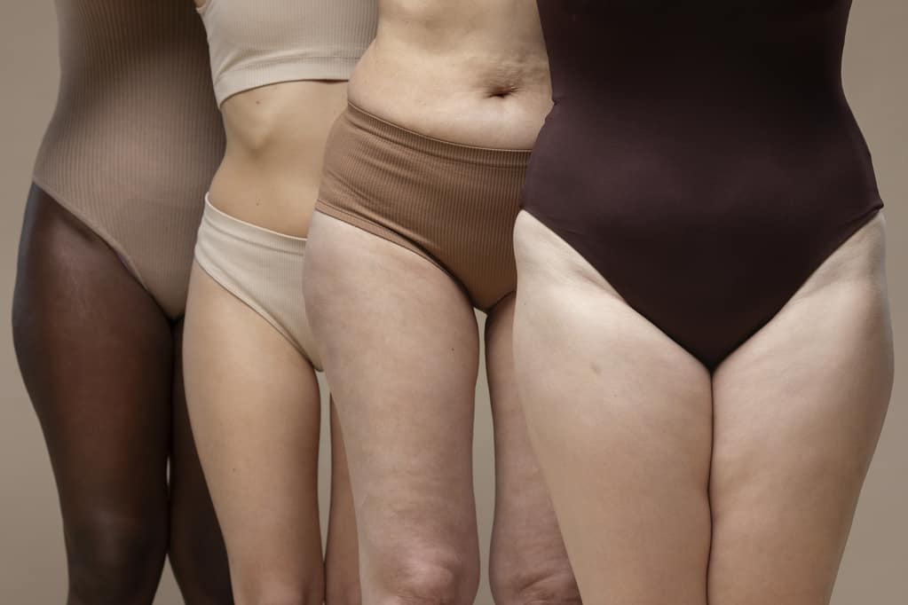 Cellulite edematosa rimedi